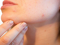 прыщи на шее примета